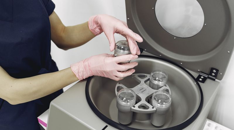 From above of crop female nurse in uniform and latex gloves standing near centrifuge and preparing equipment for plasmolifting procedure in salon
